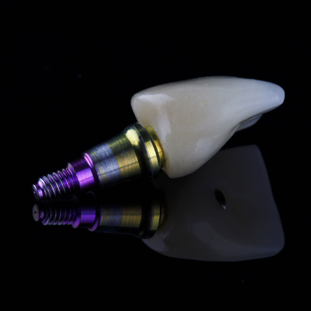 endzell gold and ceramic lab__services_implants-custom-abutments